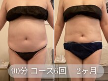 ラシク 吉祥寺(LACHIC)/ぽっこりお腹改善