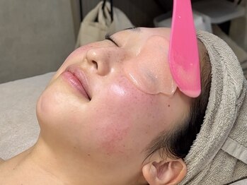 エルピス(ELPIS)/鎮静最強ハイドロジェリーパック