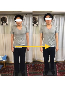 新橋整体グッドラックカイロプラクティック(Good Luck)/前から見て歪んでいるのが分かる