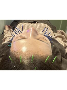 毛穴ケアをしたい