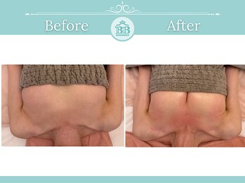 美人バスト 浜松店/◆バストアップ &nbsp;BeforeAfter◆