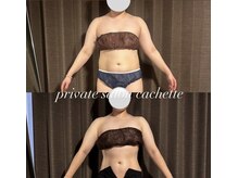 カシェット(cachette)/