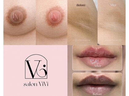 サロンヴィヴィ 大阪心斎橋店(salon ViVi)の写真