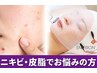 【ニキビ・皮脂トラブルの方】エンビロンピーリングトリートメント+AI肌診断