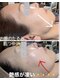 キングスサロン 長崎佐世保店(KING’S SALON)の写真/毛穴・くすみ・ニキビ・たるみをケア！Waxでうぶ毛を肌負担なくとり水光肌へ♪