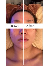 ビューティーサロン リリー(Lily)/