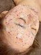 マカナ(makana)の写真/業界で話題のW脱毛★wax&光脱毛&ハイドロジェリーパック付き★肌悩みに合わせて選べる大人気メニュー♪