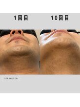 パーミル(per mille‰)/Before/After