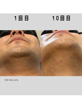 パーミル(per mille‰)/Before/After