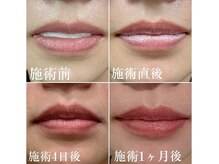 アンドワイ バイ サロンリーナ(&y by Salon Lena)/【旭川初上陸ローマピンク】