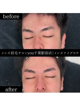 ユー 千葉駅前店(you)/ビフォ－アフター写真