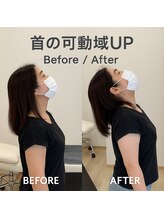 ラクナル 福岡市東区店(Laknal)/ストレートネック矯正・姿勢改善