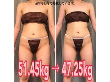 ボディエステティック アクアオーラ 富山店/産後のダイエット！