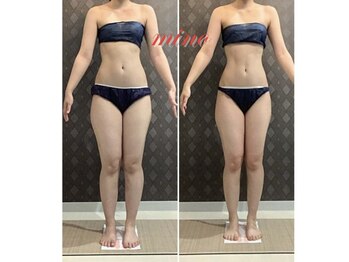 ミノ 美里大通り店(mino)/ダイエットパッケージ