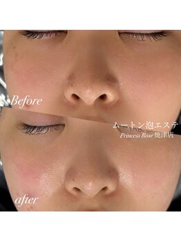 プリンセスローズ 焼津店(Princess Rose)/ムートン泡エステ