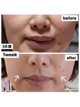 アバンギャルド(Avantgarde)/