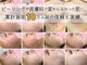 ロエヴェ(ROEWE)の写真