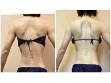 ルピナージュ(Lupinage)/ビフォーアフター