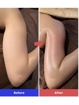 ナッティ(natti)/二の腕すっきり♪