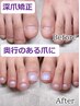 【フット】深爪矯正 長さ出し10本＋カラー★初回オイルプレゼント¥13000→