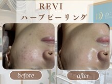 ディアーム 光明池店(Diarm)