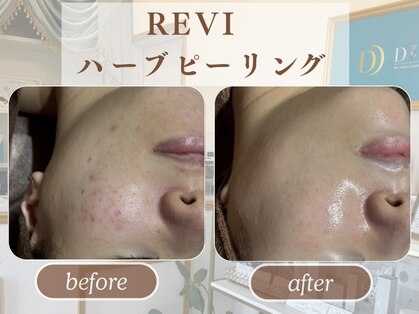 ディアーム 光明池店(Diarm)の写真