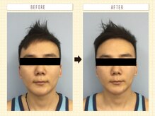 コロナ整体 神宮前院(Corona.整体)/小顔 Before&After〈原宿/小顔〉