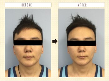 コロナ整体 神宮前院(Corona.整体)/小顔 Before&After〈原宿/小顔〉