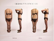 ベルミナ(Belmina)/大名/天神/毛穴/脱毛/痩身