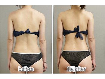 ビオラ(美ola)の写真/【筋膜リリース×姿勢改善】深部のコリまでしっかり解す！ガチガチのお身体・むくみに◎