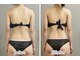 ビオラ(美ola)の写真/【筋膜リリース×姿勢改善】深部のコリまでしっかり解す！ガチガチのお身体・むくみに◎