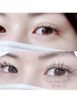 ジル(JILL)/メーテルロッド