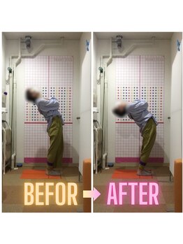 みずき整骨院 骨盤本舗/BEFOR/AFTER