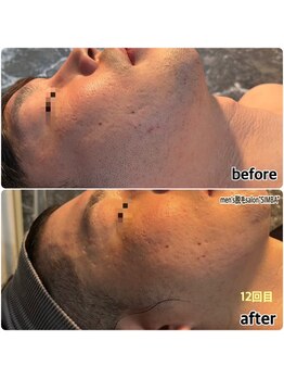 シンバ 倉敷店(SIMBA)/