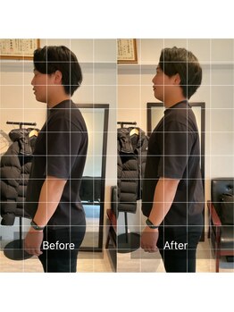 リュクス 恵比寿 代官山(LUXE)/施術(美容整体) Before After