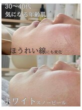 マウム(MAUM)/年齢肌、シワ、ほうれい線にも