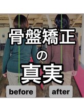 カワル整体 上通り院/骨盤矯正の真実