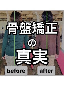 カワル整体 上通り院/骨盤矯正の真実