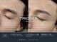 トリガー(TRIGGER)の写真