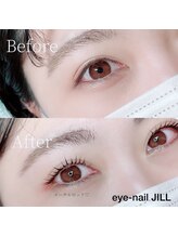 ジル(JILL)/メーテルロッド