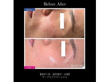 オアオア(OAOA)の雰囲気（毛穴洗浄/肌質改善/エイジングケアはOAOAにお任せください♪）