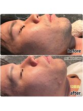 シンバ 倉敷店(SIMBA)/