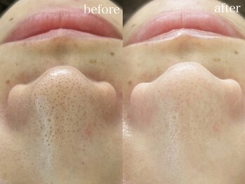 テオリア(TEORIA)/