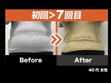 みらい平オレンジ整骨院/ダイエットコース