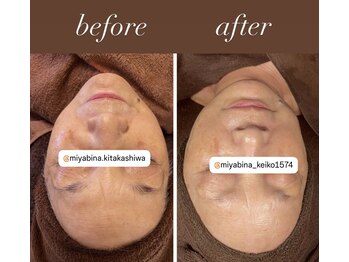 雅菜(miyabina)/70代からの　本気の肌質改善！！