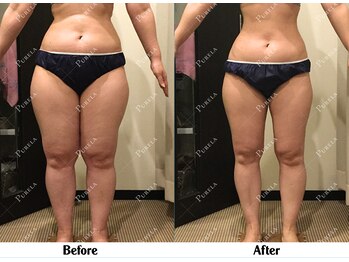 ピュアラ 心斎橋店/1年間の継続効果の比較