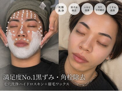 ソル(SOLL)の写真