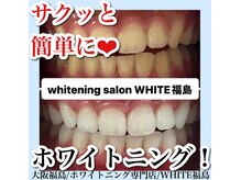 ホワイトニングサロン ホワイト(WHITE)/セルフホワイトニング/大阪/福島
