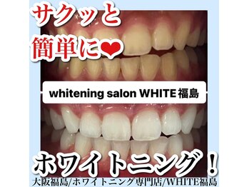 ホワイトニングサロン ホワイト(WHITE)/セルフホワイトニング/大阪/福島