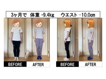 まもる整体サロン 宇部店/小顔/痩身/シミ/リンパ